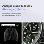 Withings ScanWatch Nova, Hybrid Smartwatch, ECG, SpO2, GPS, Grün